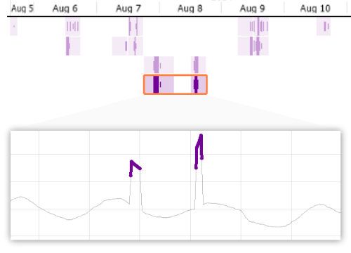 Time series anomaly detection in Visplore